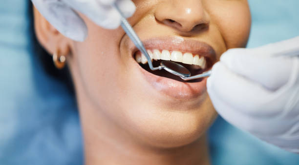 Best Emergency Dental Care for Sports Injuries in Hutchinson, KS