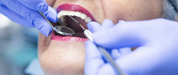 Best Emergency Root Canal Therapy in Hutchinson, KS